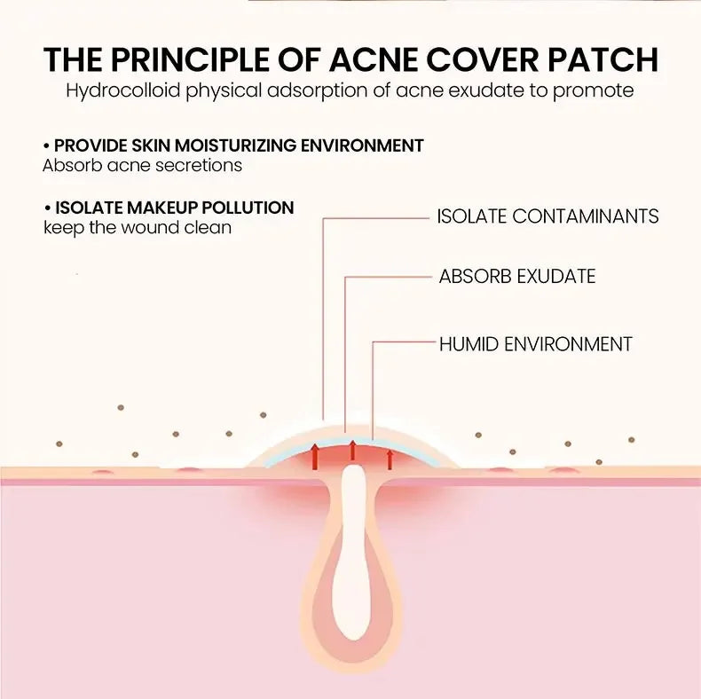 200pcs Repair Acne Patch Facial Skin Care Fade Blemishes Pimple Marks Closed Acne Blemishes Cover Acne Pimple Repair Patch